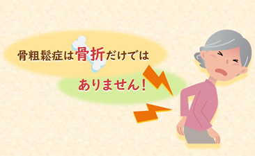骨粗鬆症は骨折だけはありません！